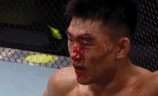 虽败犹荣！UFC头条赛：宋亚东遭桑德哈根TKO 伤势过重比赛被叫停