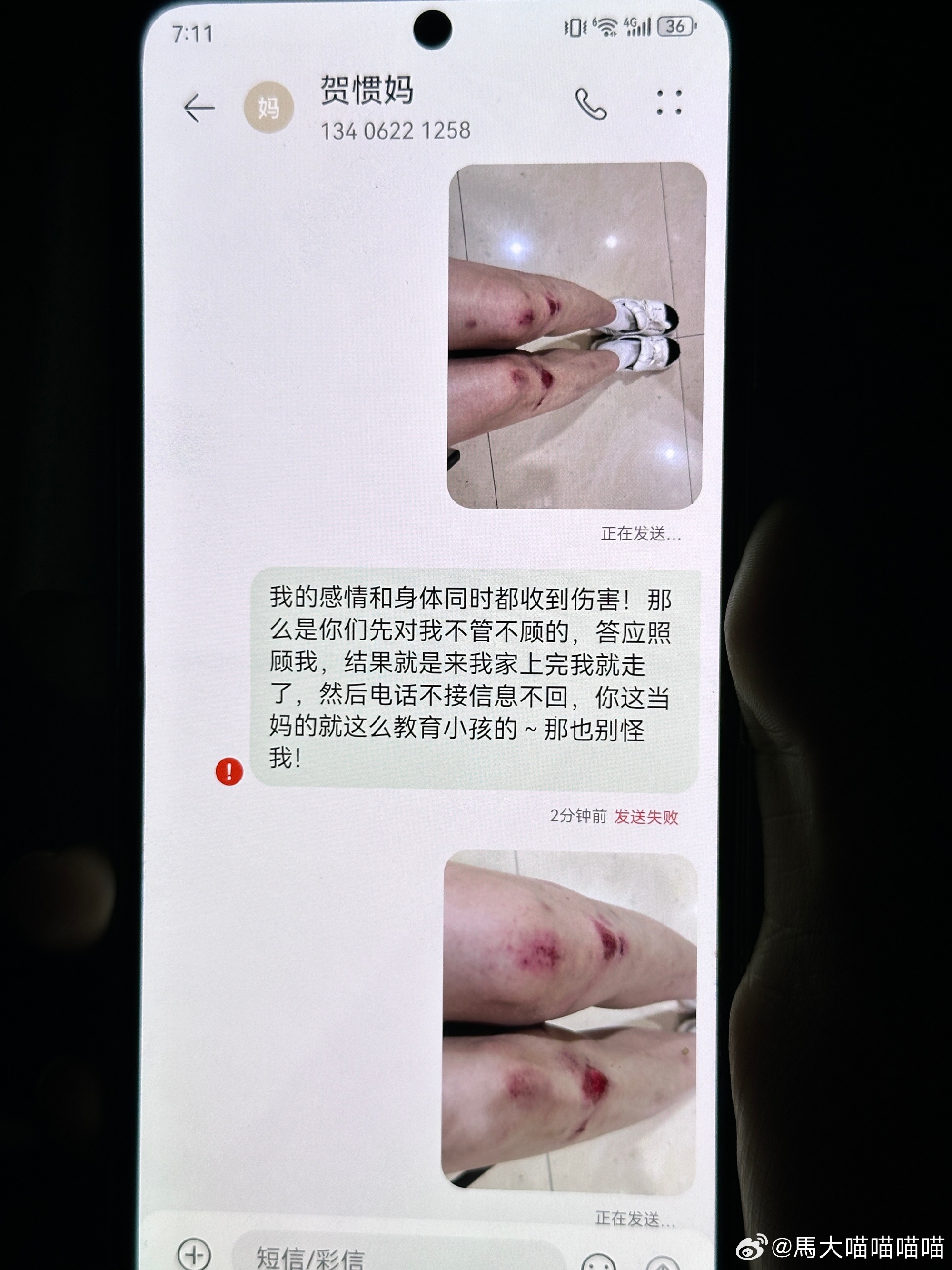 女子再晒受伤照喷贺惯母子：每次说的很好听，但每次都是欺骗